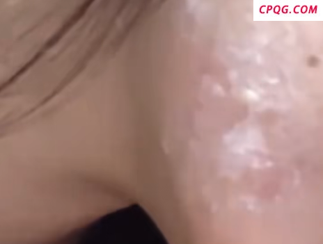 女子回应唱K感染病毒