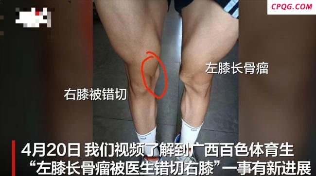 体育生被错切右膝医疗纠纷案将开庭