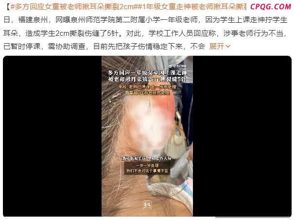 女孩被老师揪耳朵致2厘米撕裂缝针？官方：涉事教师已停课协助调查