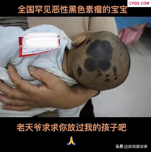 4岁抗癌小网红洋洋去世 人间疾苦丧子痛