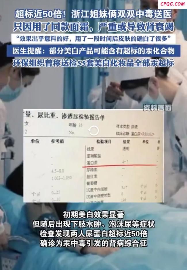 浙江姐妹俩用美白面霜尿蛋白超标50倍