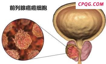 美为何反对邀泽连斯基参加北约峰会 打破传统引关注