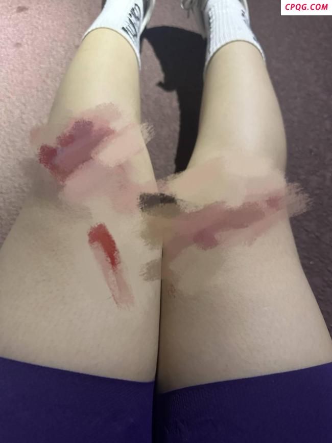 女子在成都绿道骑行被鱼线绊倒 安全隐患引关注
