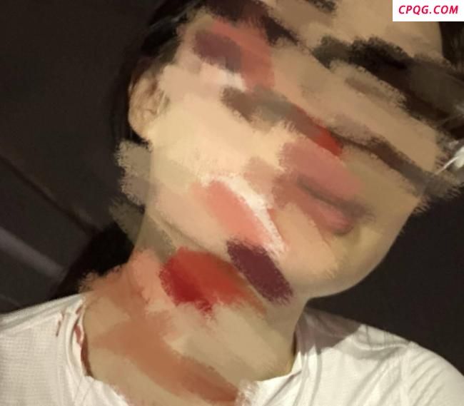 女子在成都绿道骑行被鱼线绊倒