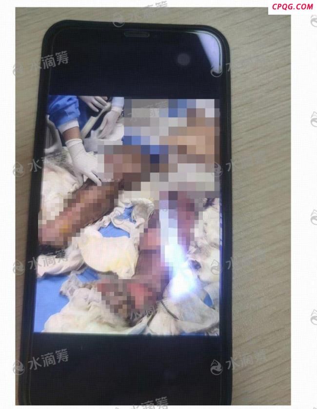 成都火灾重伤女孩被提前录取 电瓶车“飞线充电”惹祸