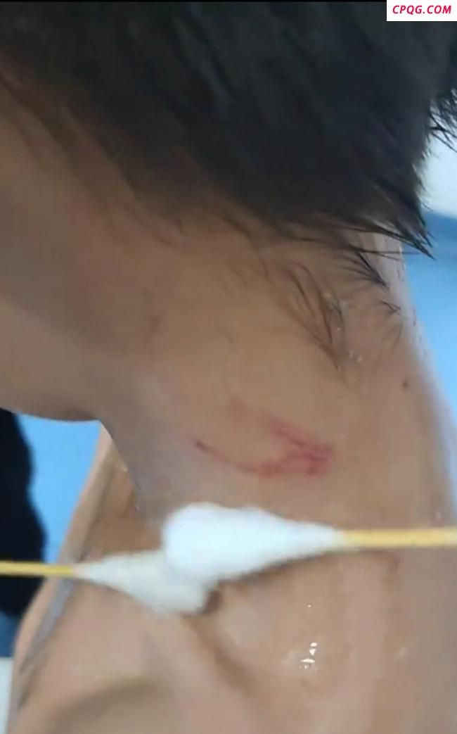男孩对小猴竖中指遭猴子群殴