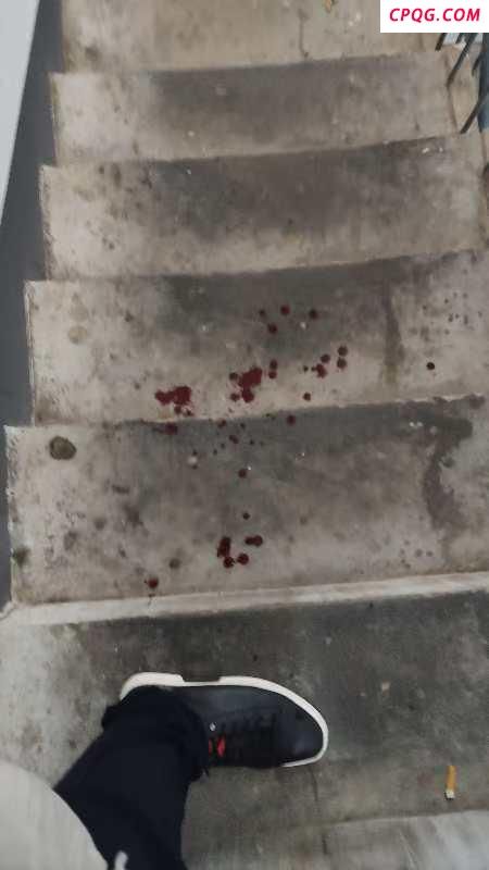 男子斥责不拴绳遭狗主人打还被尾随
