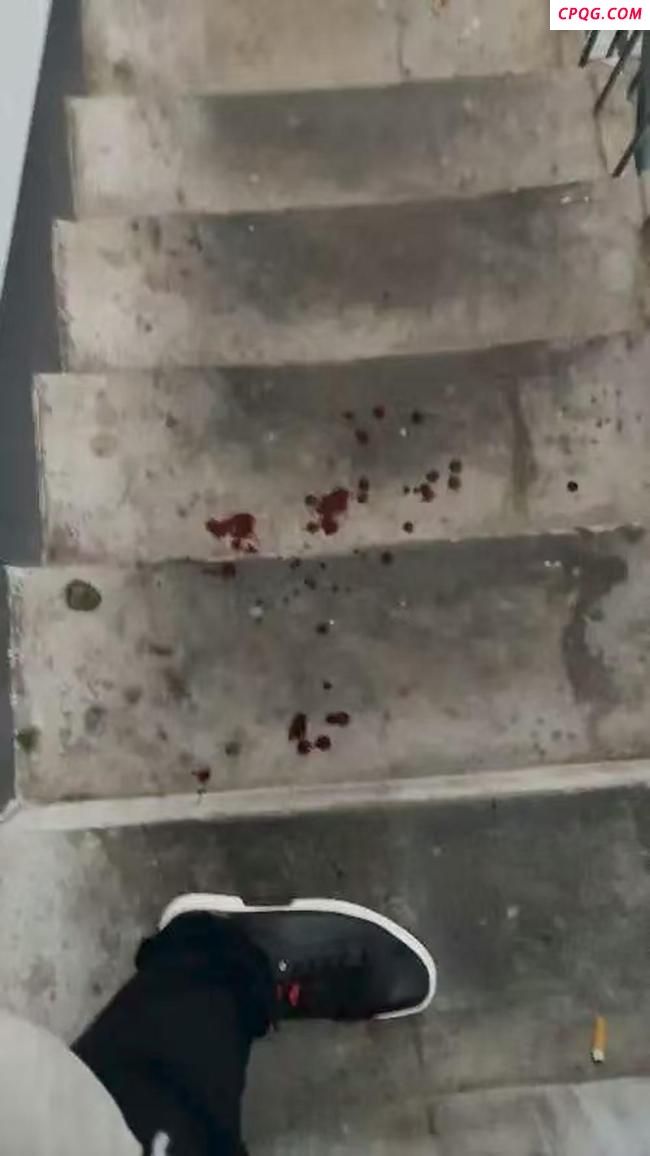 狗未拴绳咬伤人 狗主人拒赔称讹人