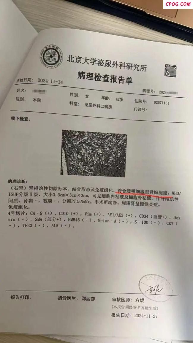 医生谈“体检正常却患癌症晚期” 十年体检未预警