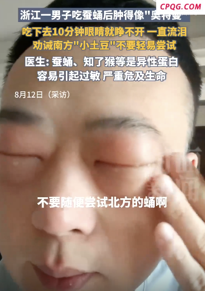 一直流泪 男子吃蚕蛹后肿得像“奥特曼” 奇异反应引热议