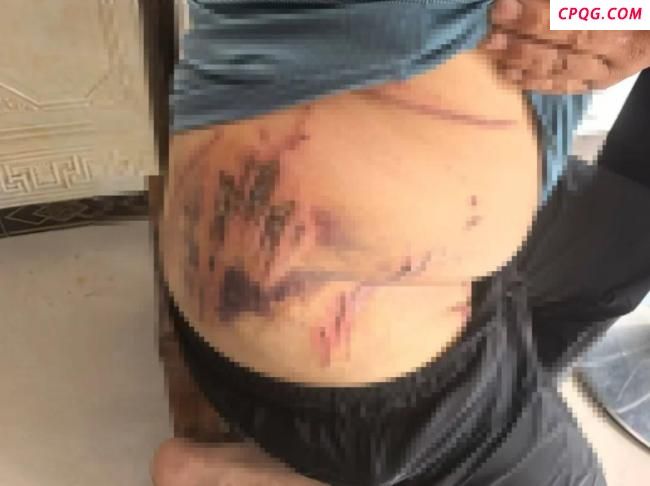 湖北一村民称遭老虎袭击 当地通报 未发现老虎活动痕迹
