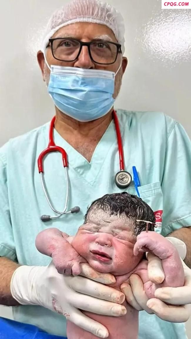 巴西男婴手握母亲节育环出生